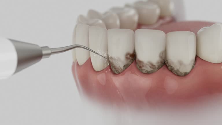 Reliable Dental contractor in Berkeley, CA by Smile Center Dentistry
